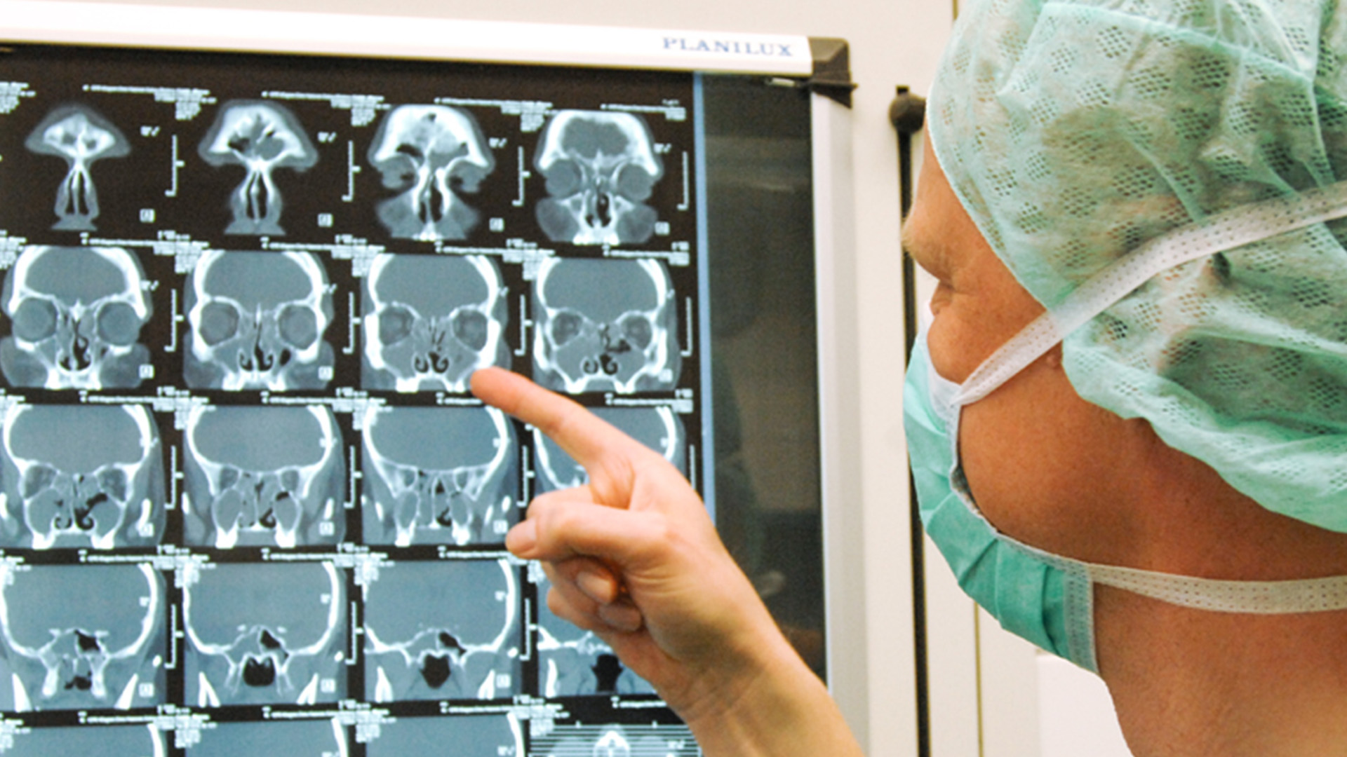 Bild Besprechung Röntgenaufnahme